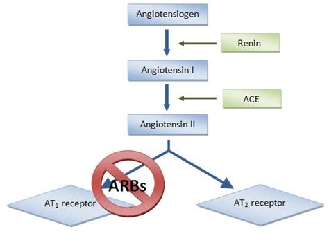 All you need to know about ARB’s – Michigan Brain & Spine Surgery Center