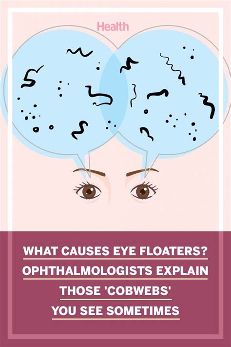Eye Floaters: Ophthalmologists Explain Causes, Symptoms, and Treatment ...