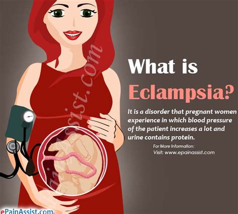 Pin on Hypertension disorder during pregnancy