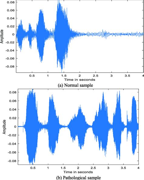 The voice samples used in the analysis. | Download Scientific Diagram