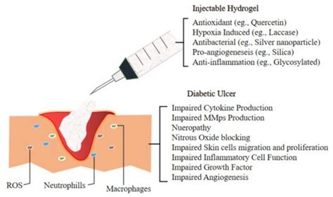 Injectable Hydrogels for Skin Wound | Encyclopedia MDPI