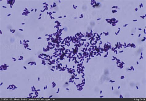 STOCK IMAGE, photomicrograph of corynebacterium diphtheriae the cause ...