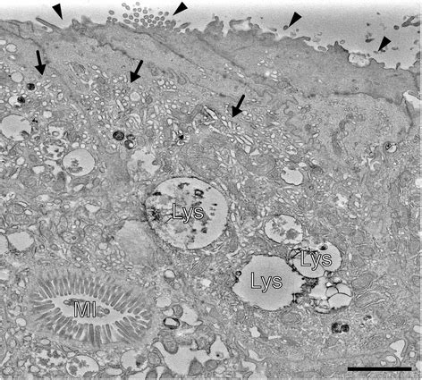 Towards understanding microvillus inclusion disease | Molecular and Cellular Pediatrics | Full Text