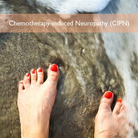 Chemotherapy-induced Peripheral Neuropathy (CIPN) Symptoms & Treatment ...