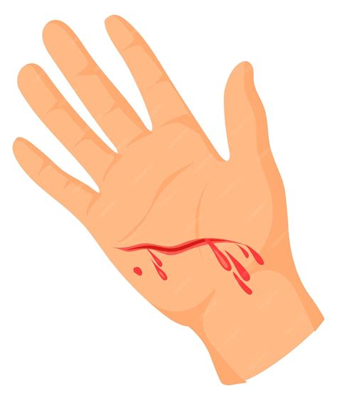 Premium Vector | Hand with bleeding cut Palm wound Injury icon