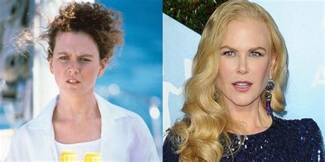 Nicole Kidman's Plastic Surgery Regret: See Her Frozen Face Before and ...