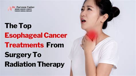 The Top Esophageal Cancer Treatments – From Surgery To Radiation Therapy