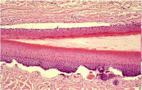 Nail pathology - Clinics in Dermatology