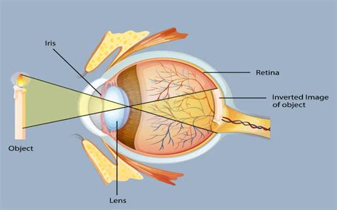 Macular Edema: Signs, Symptoms, Causes, and Treatment