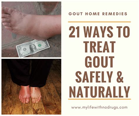 21 Home Remedies For Gout: Treat Gout Safely & Naturally - My Life With ...