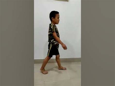 #Duchenne Muscular dystrophy #Lordotic posture #waddling gait due to ...