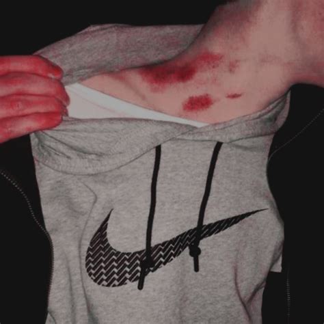 hickeys, aesthetic | Hickeys, Hickies, Hickies neck