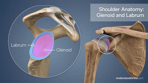 Trimming of Torn Labrum – UnderstandOrtho™