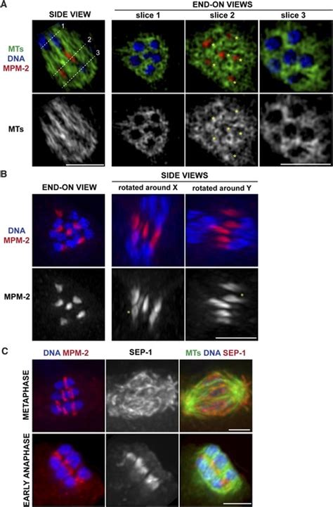 Kinetochore-independent chromosome segregation driven by lateral microtubule bundles | eLife