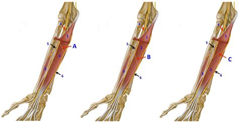 Vista anterior, antebrazo derecho. 1: Músculo flexor superficial de los... | Download Scientific ...