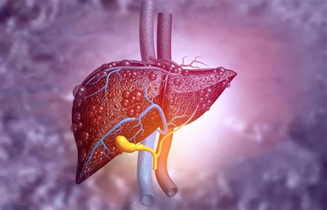 Diagnosing liver damage early could save your life, now researchers have developed a non ...