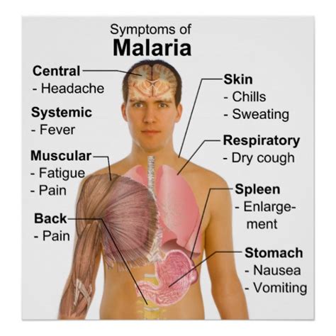 Malaria Fever In Children: Symptoms, Treatment, And Prevention In The ...