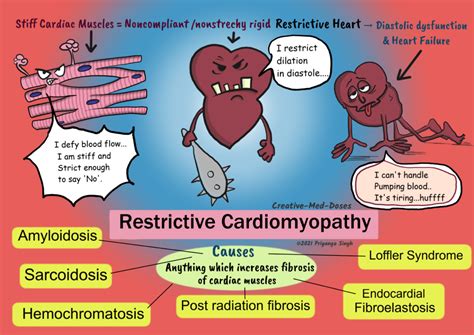 Restrictive Cardiomyopathy: Stiff Ventricles - Creative Med Doses