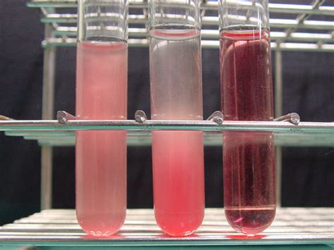 Hemolysis - wikidoc