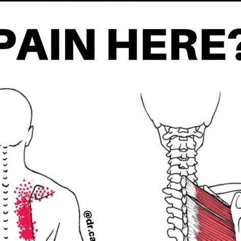 What releasing a knot looks like massage techniques – Artofit