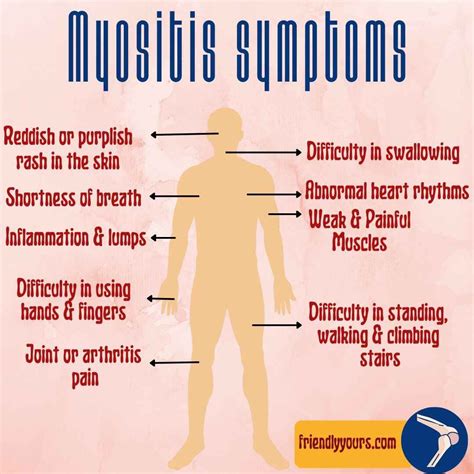 Is there any natural treatment for myositis? Know its causes, symptoms ...