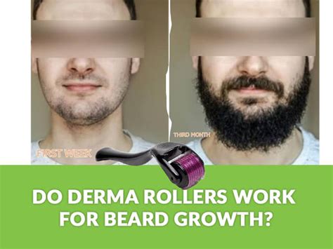 Derma Roller For Beard Before And After: Do Derma Rollers Work for Beard Growth?