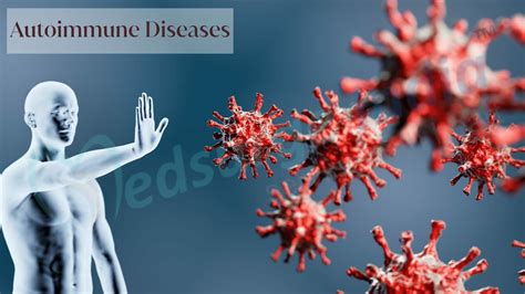 Autoimmune Diseases | Types , Causes & Treatment | Medsurge India