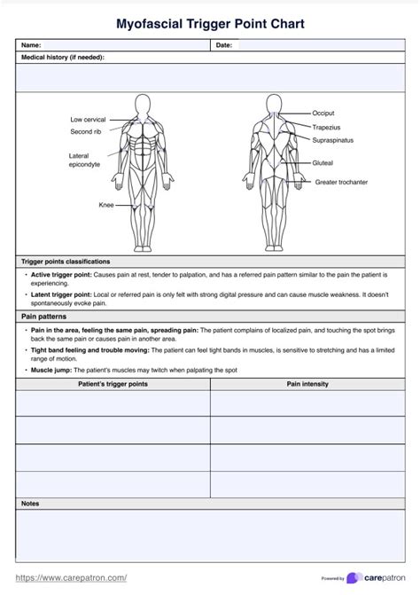 Trigger Point Chart & Example | Free PDF Download