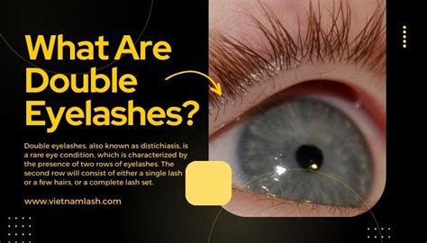 What Are Double Eyelashes? Let's See How Rare They Are!