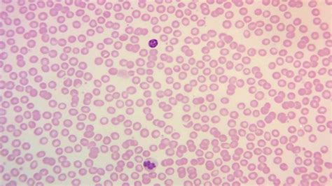 Leishman Stain & Blood Smear: Principle, Procedure & Composition