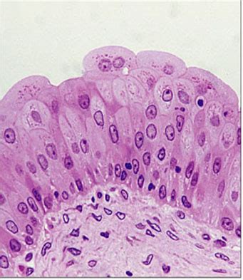 urinary histology