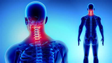 What Is Cervical Pain? Causes, Symptoms and Treatment