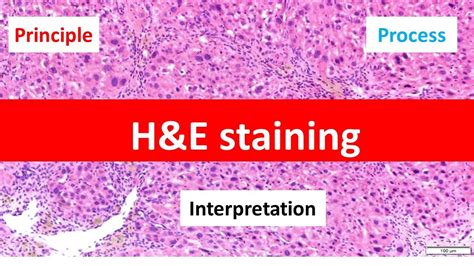 HE Staining: Principle, Procedure, and Interpretation | Haematoxylin and Eosin Staining | - YouTube