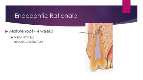 Luxation tooth injuries