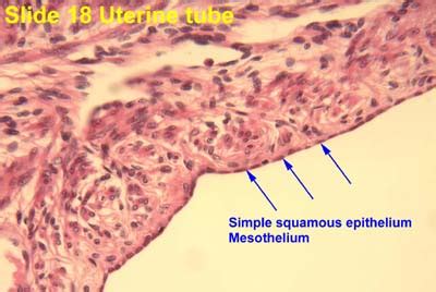 Simple Squamous Epithelium Slide