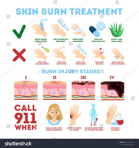 Tratamiento de lesiones por quemaduras de: vector de stock (libre de ...