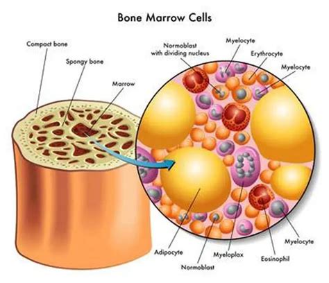 Pictures Of Bone Marrow