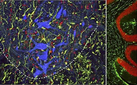 Researchers have developed a new method for delivering neural precursor cells into spinal cord ...