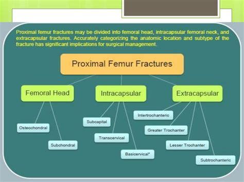 Nof fracture