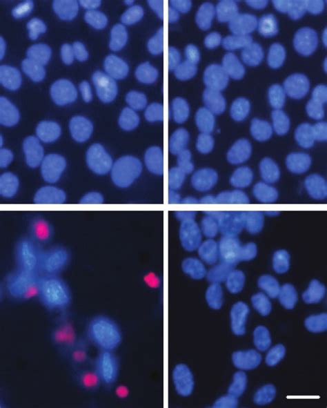 Apoptosis triggered by CDK inhibitory drugs is blocked by the double... | Download Scientific ...