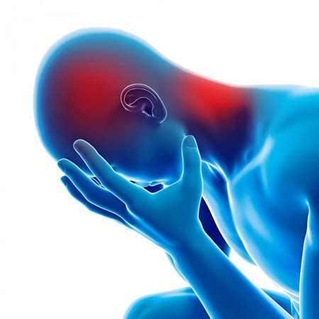 Temporal Headache Pain Relief | Mind & Body Chiropractic