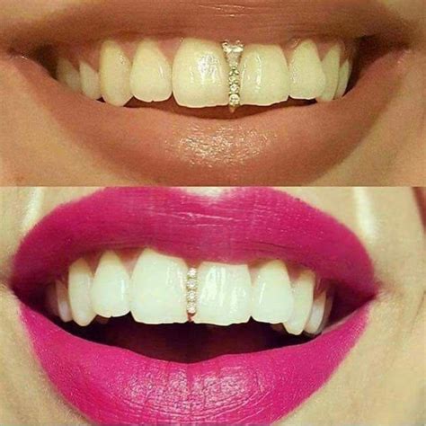 Grill To Fix Your Gap Tooth. Yes Or No? - Fashion - Nigeria