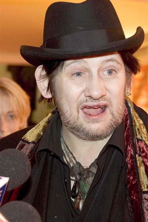 The Pogues' Shane Macgowan boasts new set of teeth