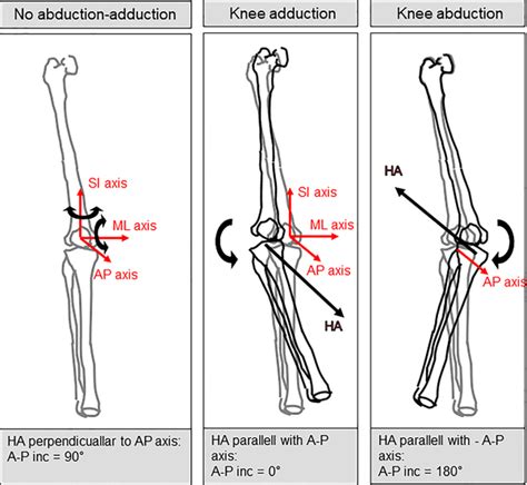 Kinematic analyses including finite helical axes of drop jump landings demonstrate decreased ...