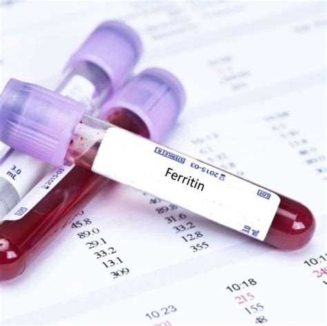 serum ferritin level blood test | VIP Lab