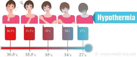 Hypothermia - Causes, Risk Factors, Symptoms, Diagnosis, Treatment, Prevention