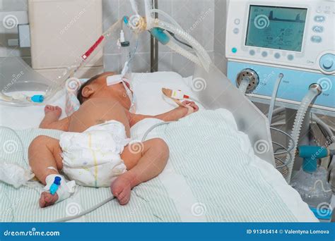 Newborn Baby with Hyperbilirubinemia on Breathing Machine or Ventilator with Pulse Oximeter ...