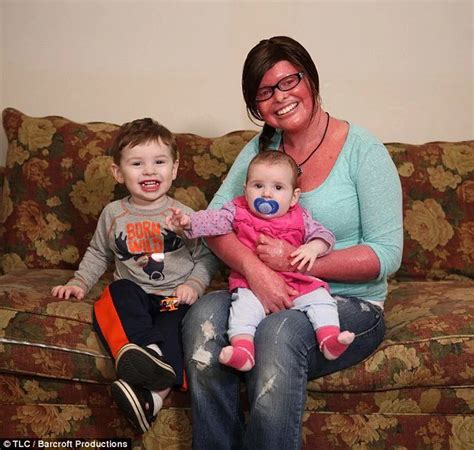 Woman With Harlequin Ichthyosis Becomes Happy Mother Tuko.co.ke