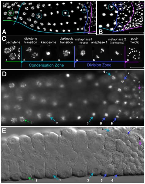 Karyosome formation during late spermatogenesis in C. elegans. Numbered ...