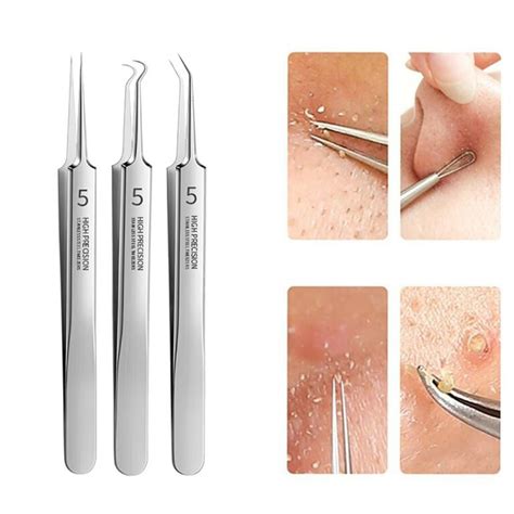 Pimples Blackhead Clip Tweezer – Dropshipping Winning Products